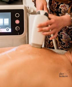 herren-rücken-haarentfernung-laser-derkokon
